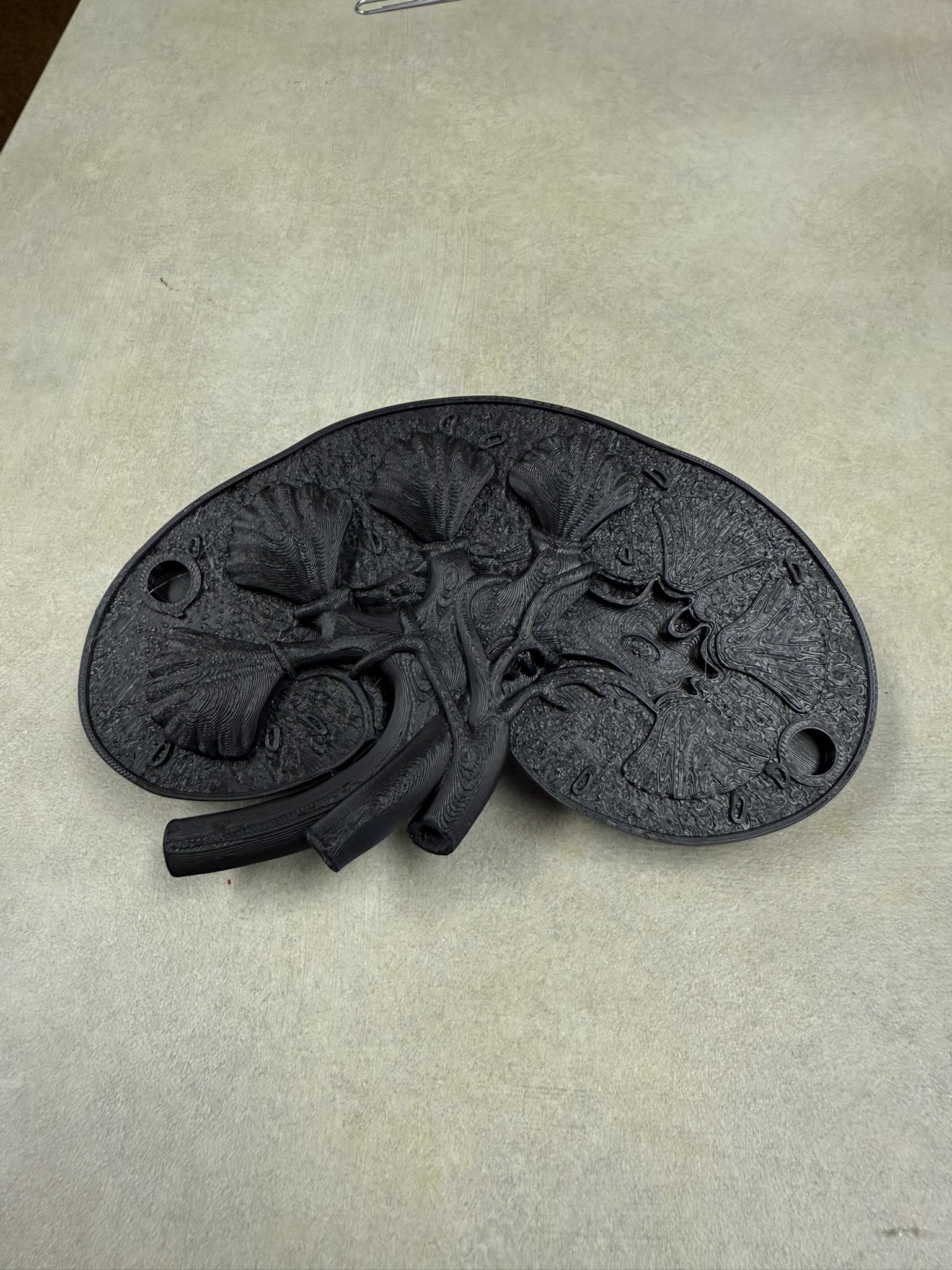 Kidney Hemisphere Model