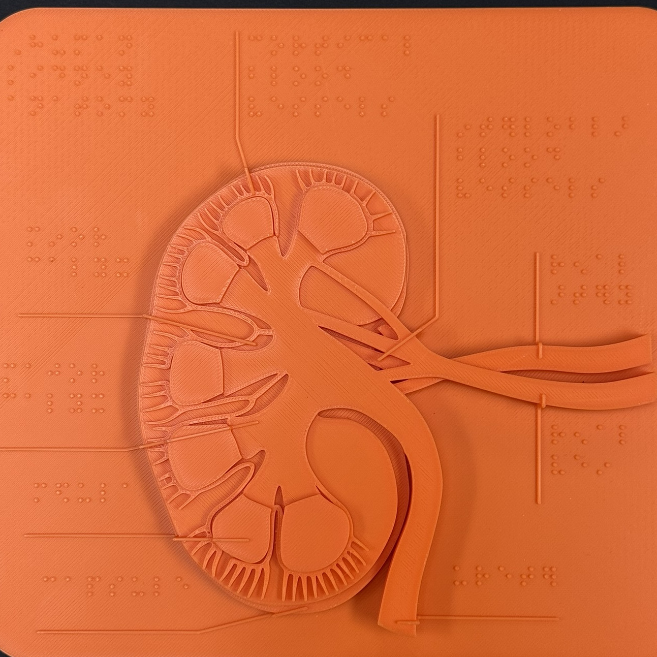 Kidney Tactile Diagram