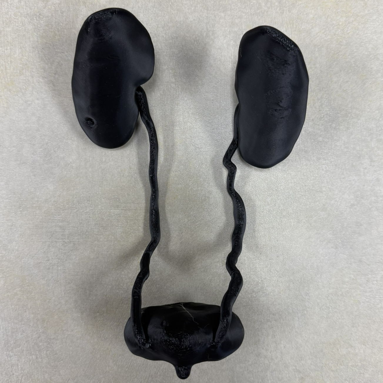 Urinary System Model